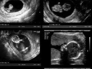 湖北省优质助孕机构推荐，成功率星级榜单揭晓