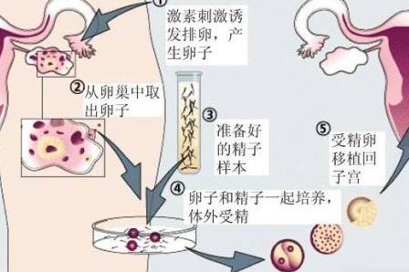 2026年邵阳哪家医院比较好？三代试管